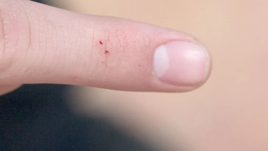 Can Bed Bug Bites Spread Disease? The Truth Revealed